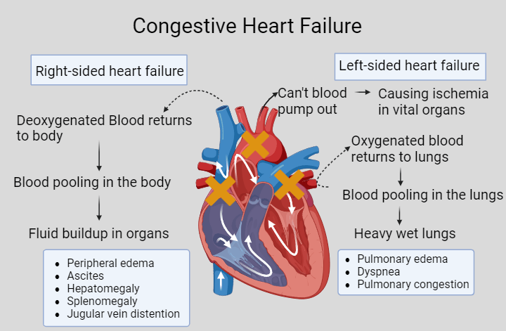 difference between heart attack and heart failure