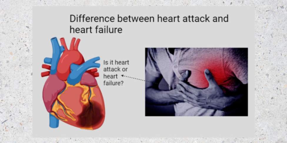 difference between heart attack and heart failure